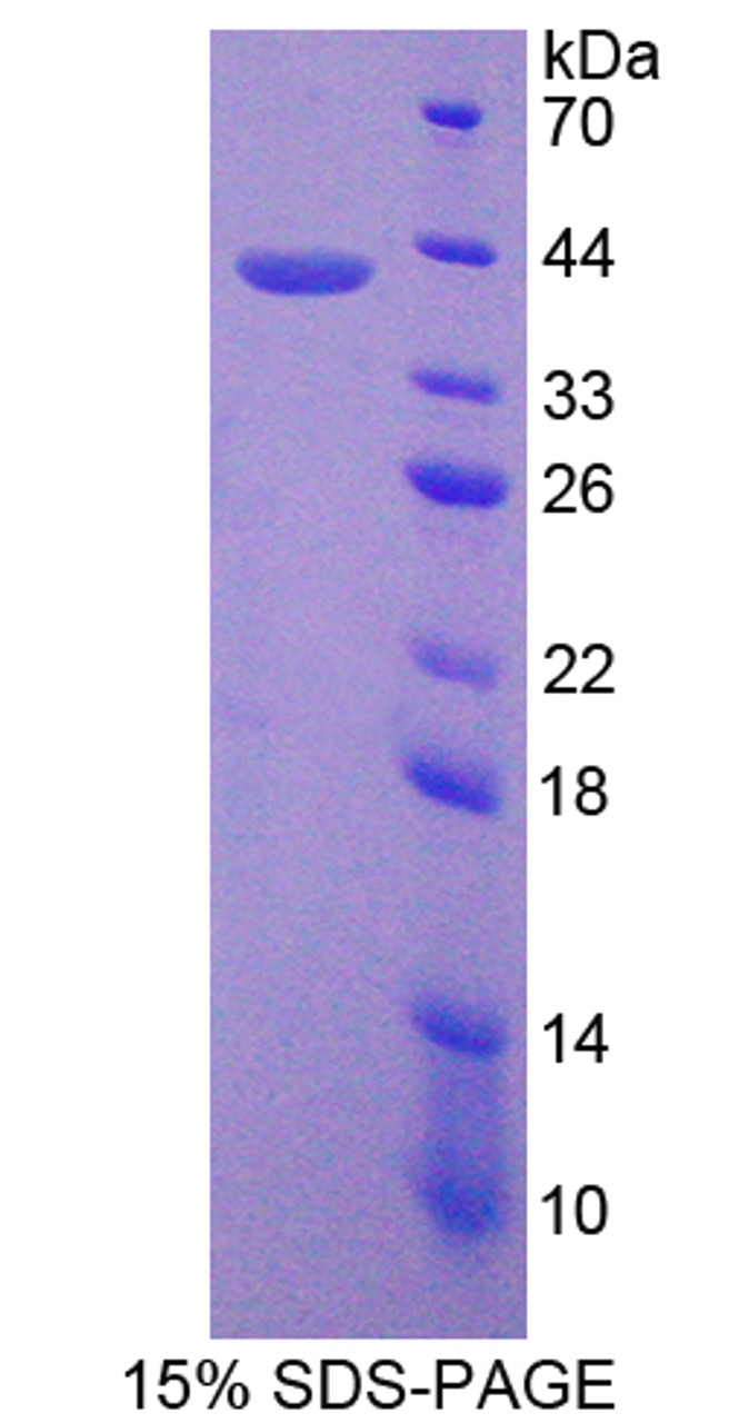 Human Recombinant G Protein Beta 2 (GNb2)