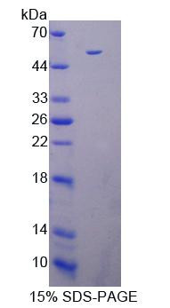 Mouse Recombinant Death Associated Protein Kinase 3 (DAPK3)