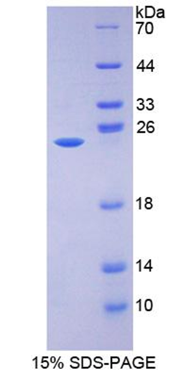 Mouse Recombinant 17-Beta-Hydroxysteroid Dehydrogenase Type 10 (HSD17b10)