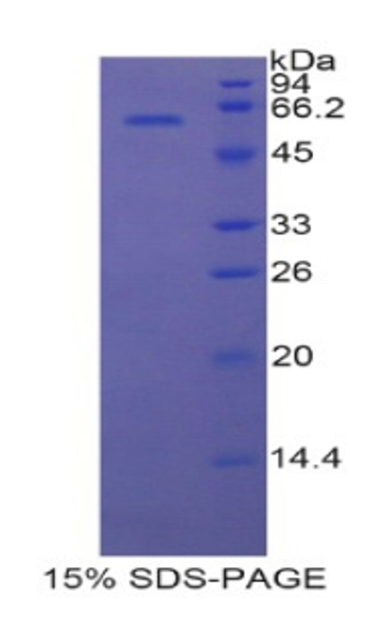 Rat Recombinant 17-Beta-Hydroxysteroid Dehydrogenase Type 12 (HSD17b12)