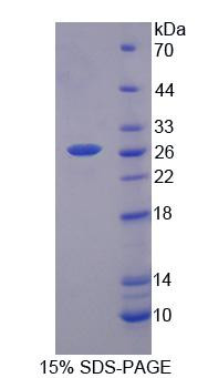Human Recombinant Bestrophin 2 (BEST2)