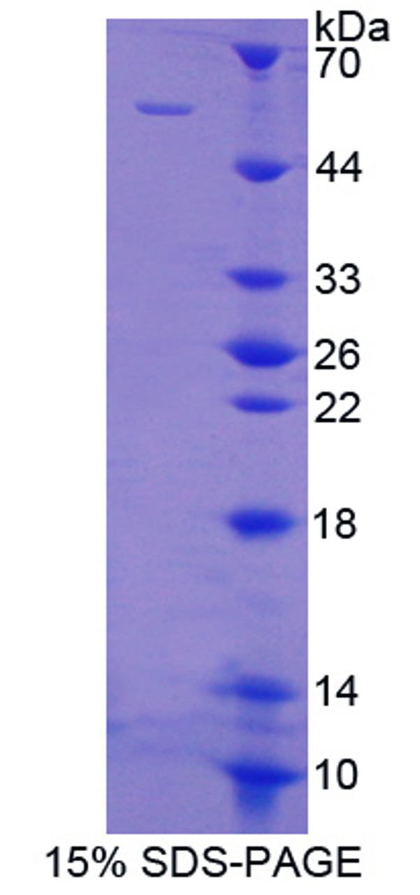 Human Recombinant Docking Protein 3 (DOK3)