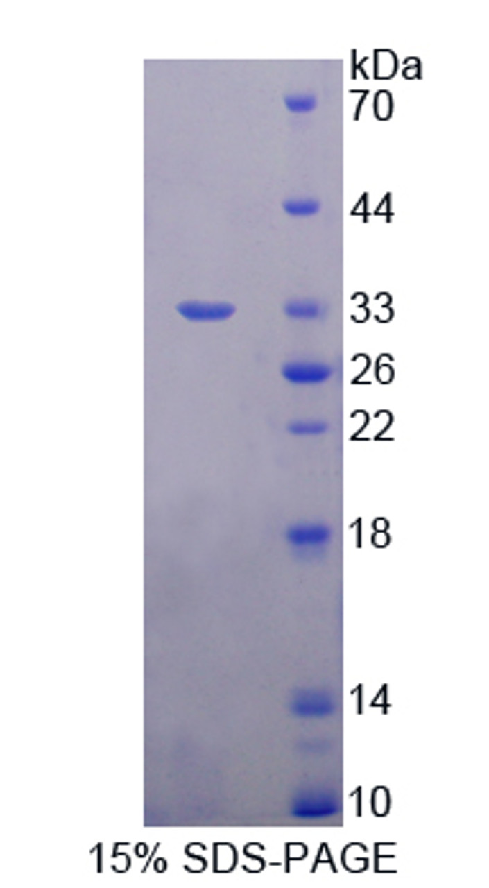 Rat Recombinant Docking Protein 3 (DOK3)