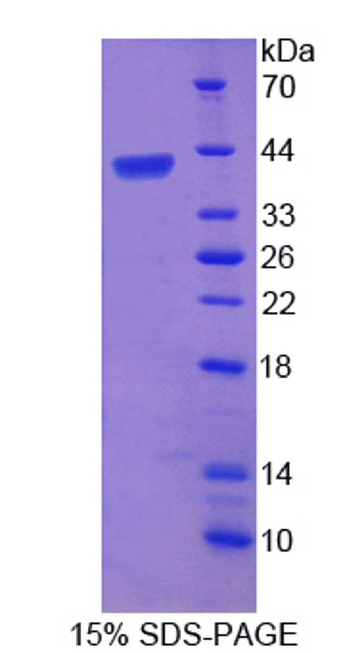 Human Recombinant Telomeric Repeat Binding Factor 2 (TERF2)