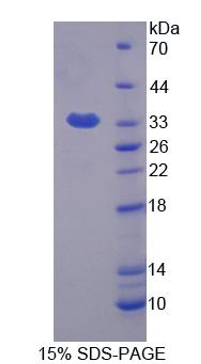 Human Recombinant Flavin Containing Monooxygenase 1 (FMO1)