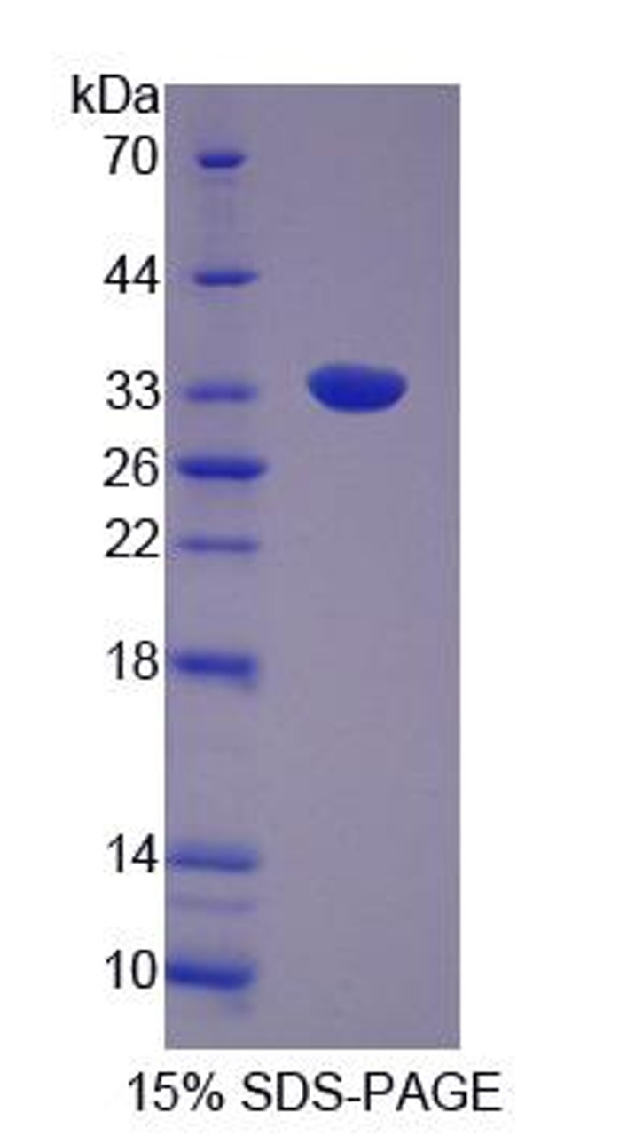 Rat Recombinant Growth Factor Receptor Bound Protein 14 (Grb14)