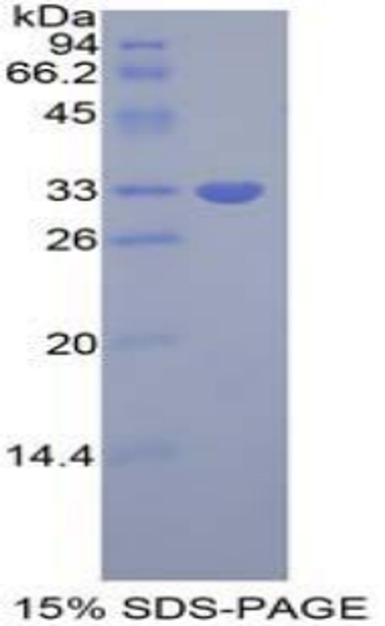 Human Recombinant Growth Factor Receptor Bound Protein 7 (Grb7)