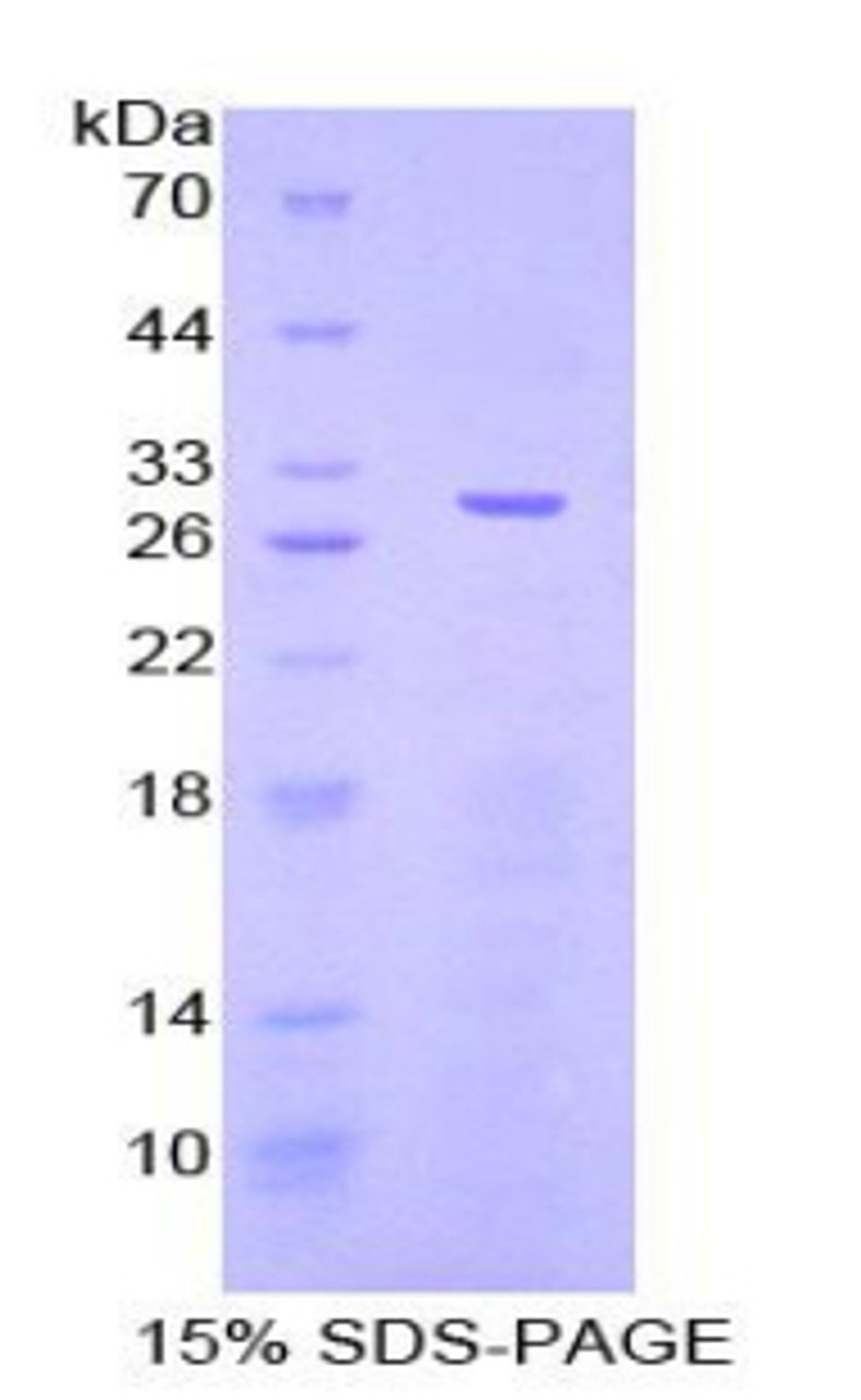 Mouse Recombinant Janus Kinase 3 (JAK3)