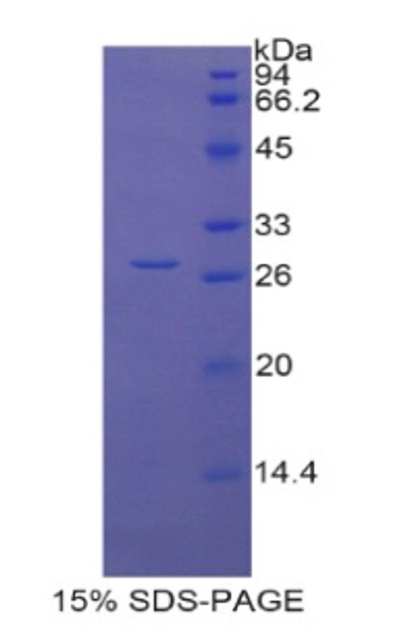 Rat Recombinant Lysyl Oxidase Like Protein 1 (LOXL1)