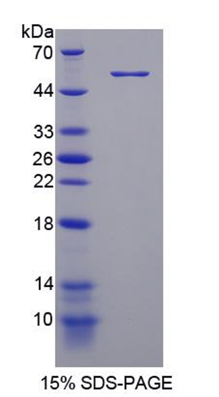 Human Recombinant Phosphodiesterase 4D, cAMP Specific (PDE4D)