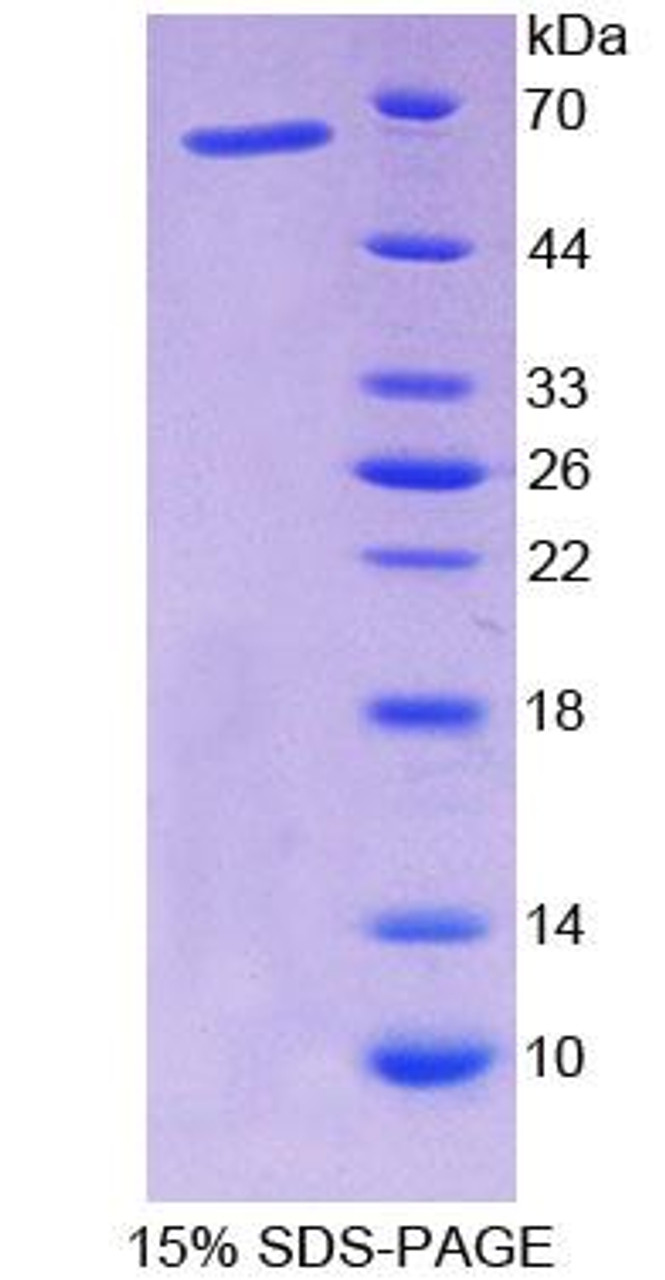 Rat Recombinant Nuclear Factor I/X (NFIX)