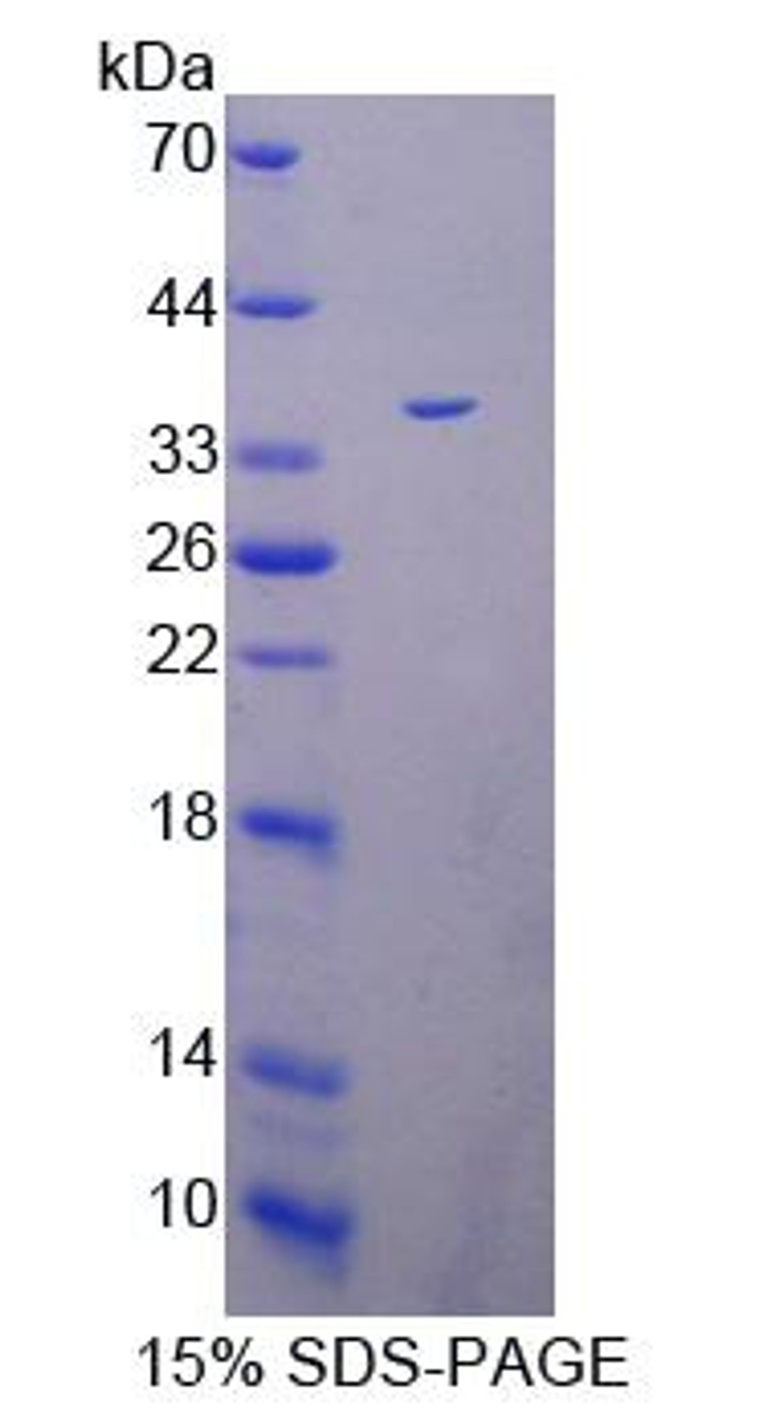 Human Recombinant Peptidyl Arginine Deimina Type IV (PADI4)