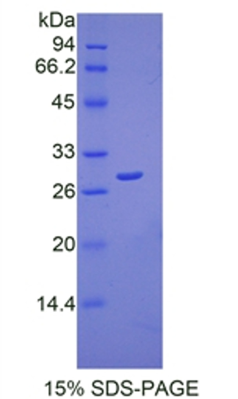 Human Recombinant Peroxiredoxin 3 (PRDX3)