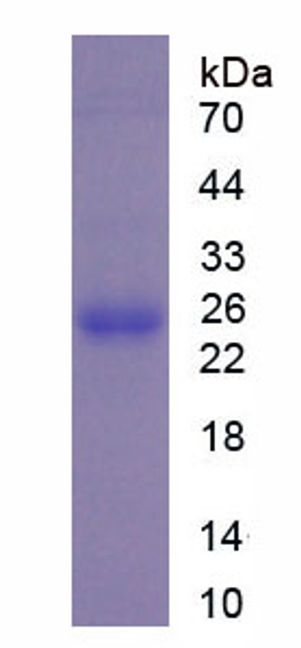 Mouse Recombinant Peroxiredoxin 4 (PRDX4)