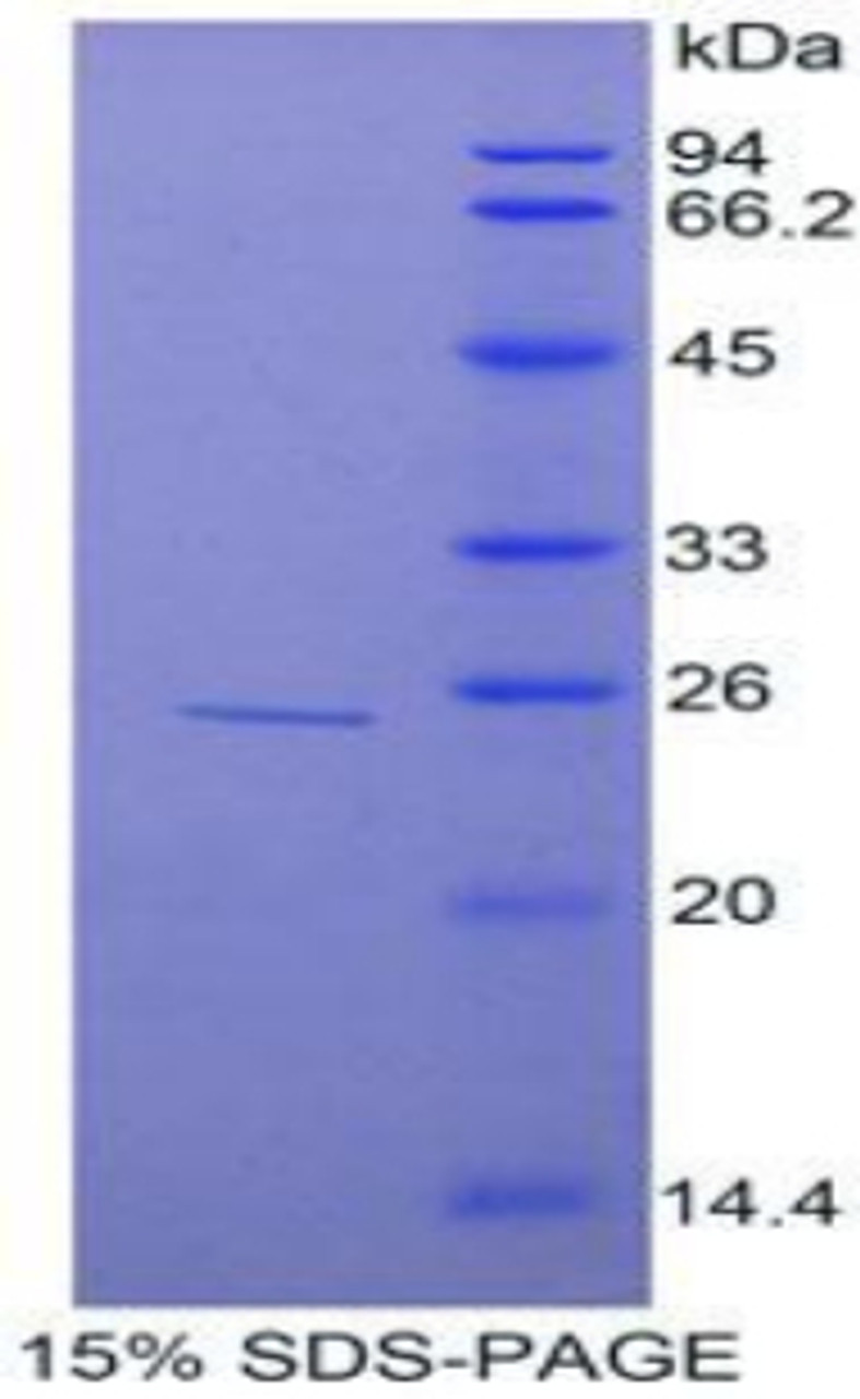 Rat Recombinant Tumor Necrosis Factor Alpha Induced Protein 3 Interacting Protein 2 (TNIP2)