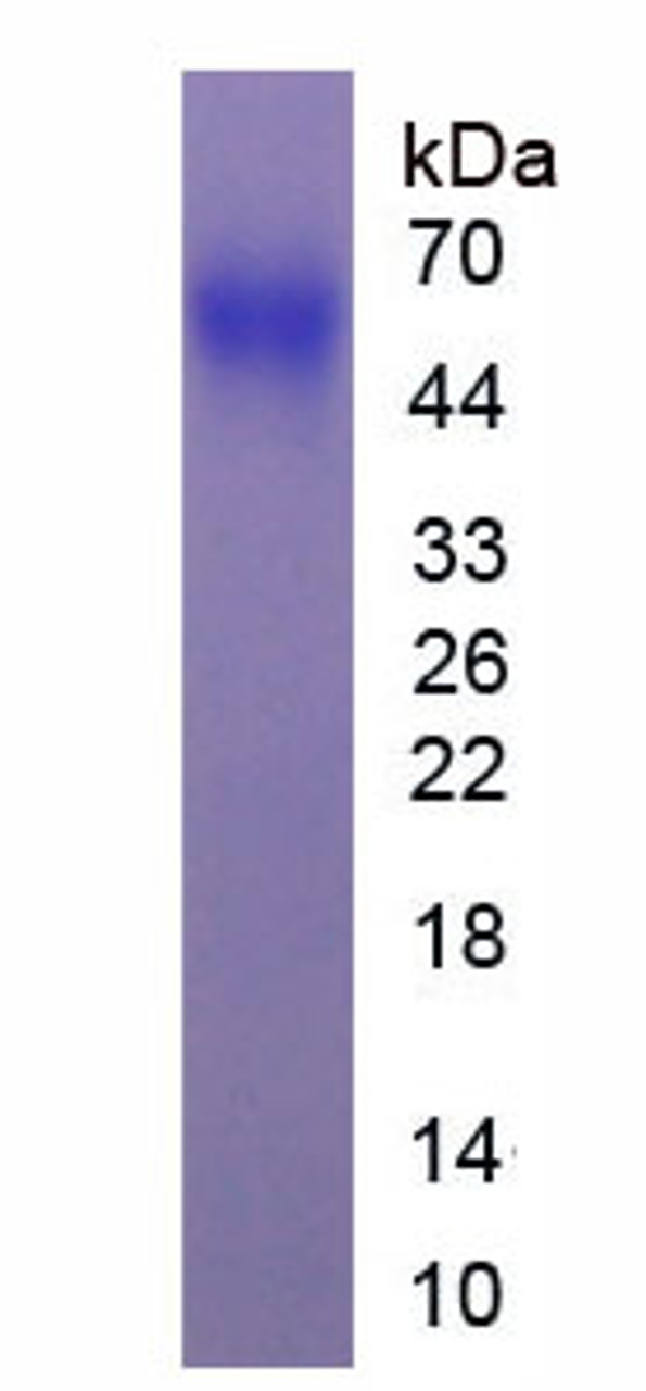 Human Recombinant Phosphatase And Tensin Homolog (PTEN)