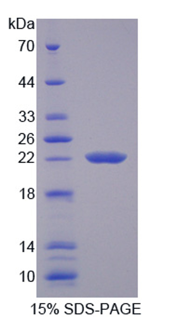 Rat Recombinant Transient Receptor Potential Cation Channel Subfamily M, Member 7 (TRPM7)