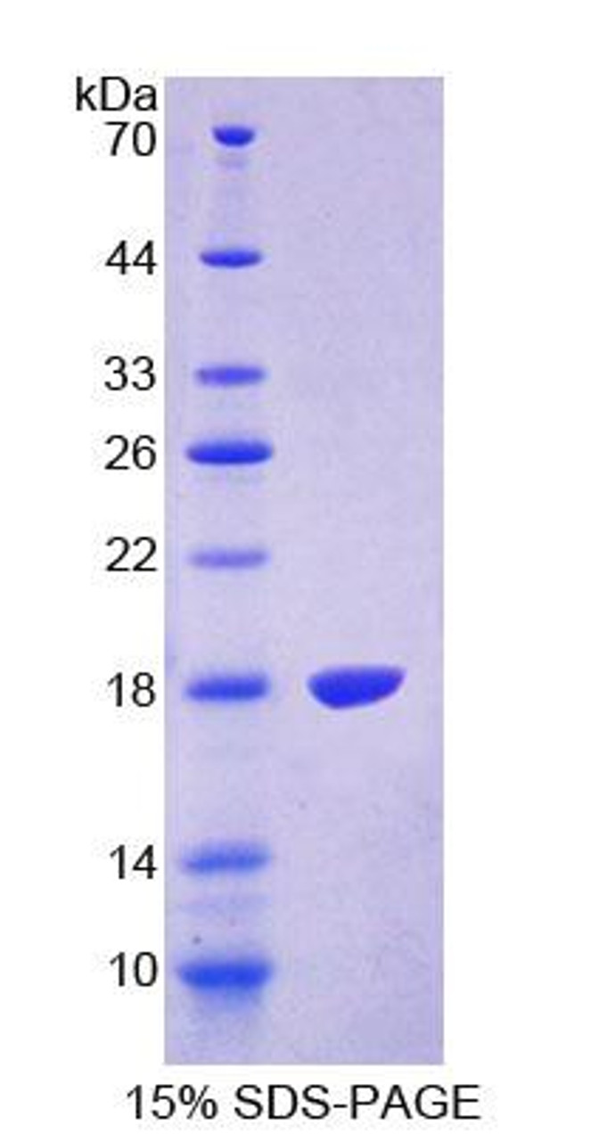 Human Recombinant Transient Receptor Potential Cation Channel Subfamily V, Member 3 (TRPV3)