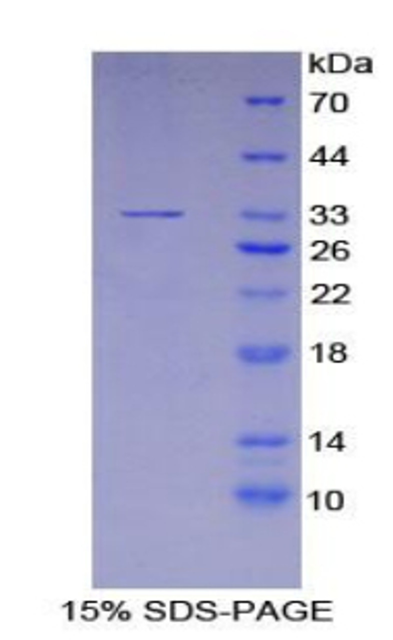 Human Recombinant Purinergic Receptor P2Y, G Protein Coupled 14 (P2RY14)