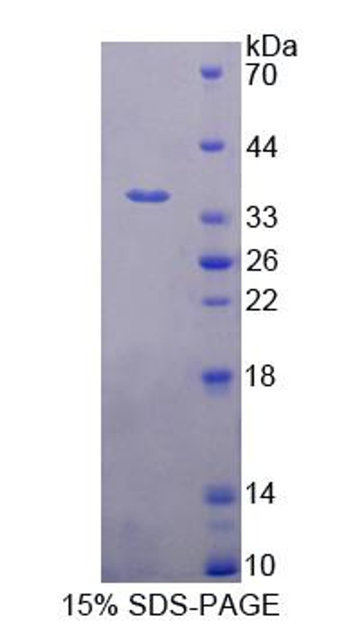 Human Recombinant Proteasome Activator Subunit 3 (PSME3)