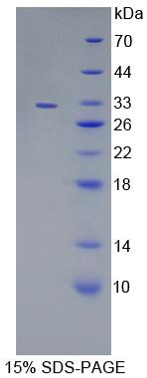 Human Recombinant Polyamine Modulated Factor 1 Binding Protein 1 (PMFBP1)