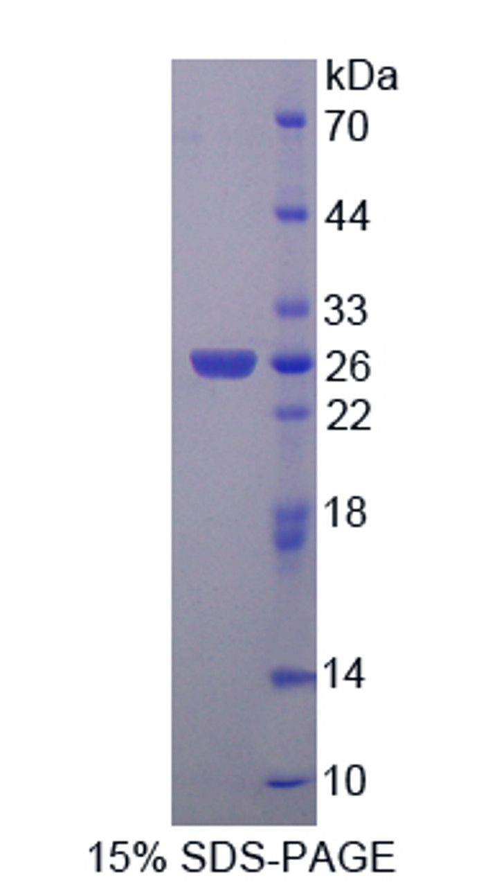 Rat Recombinant Nephroblastoma Overexpressed Gene (NOV)