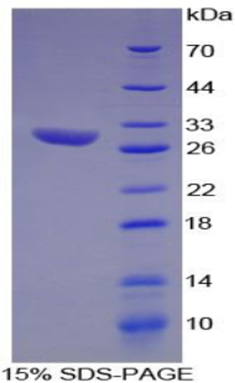 Rat Recombinant Hydroxyacid Oxidase 1 (HAO1)