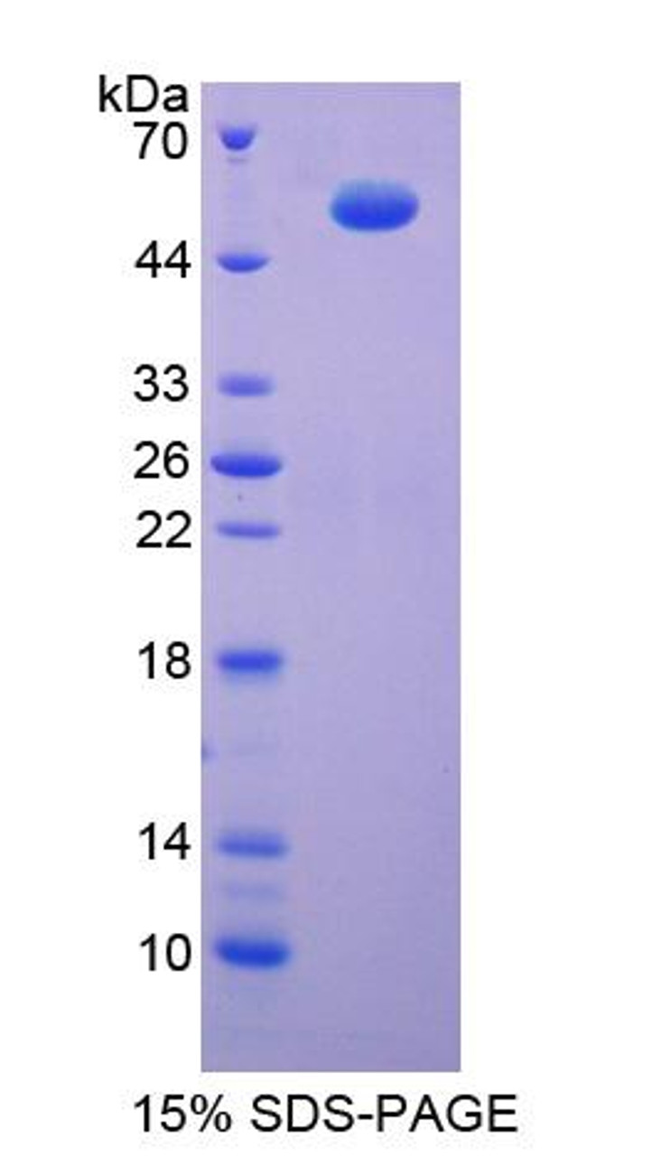 Rat Recombinant ATPase, H+ Transporting, Mitochondrial F1 Complex Beta Polypeptide (ATP5b)