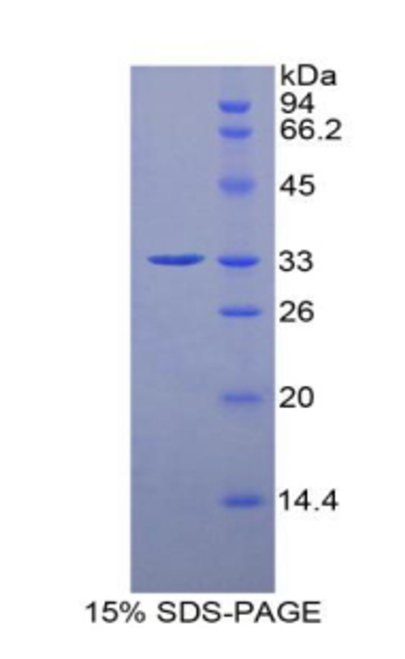 Rat Recombinant Histidine Decarboxylase (HDC)