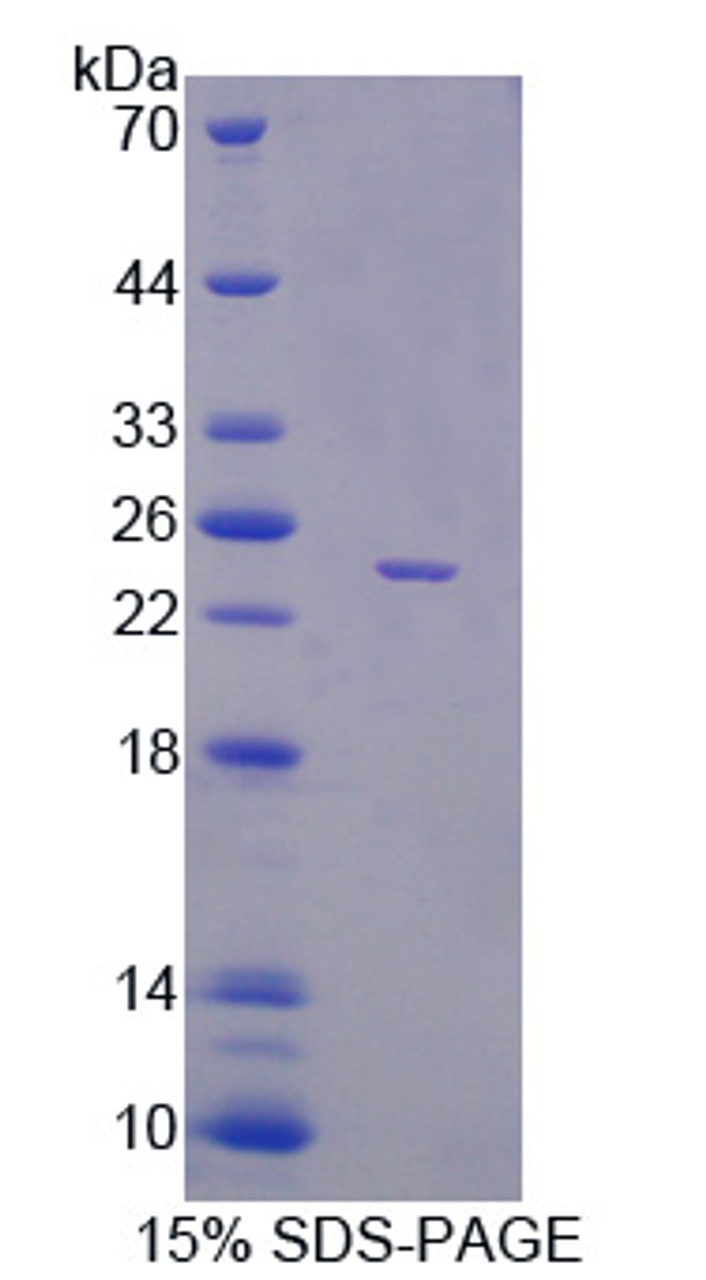 Mouse Recombinant Phosphatidylethanolamine Binding Protein 1 (PEBP1)