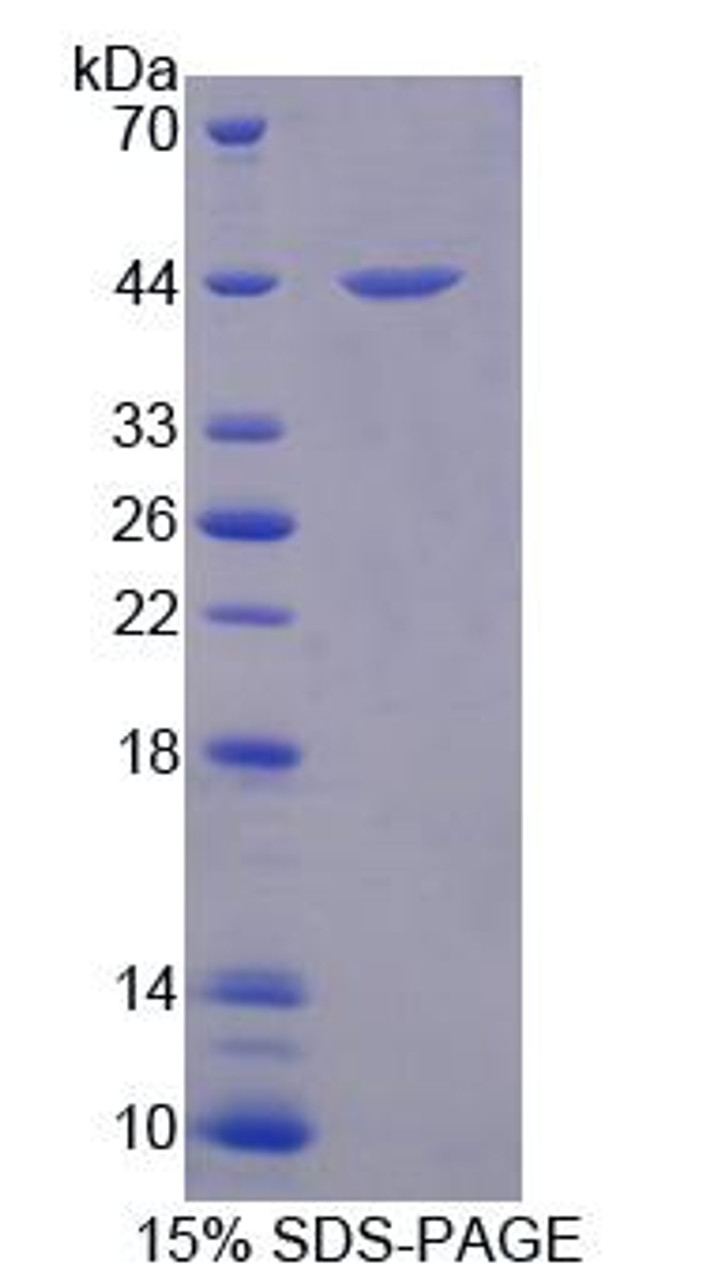 Human Recombinant Steroid Sulfatase Isozyme S (STS)