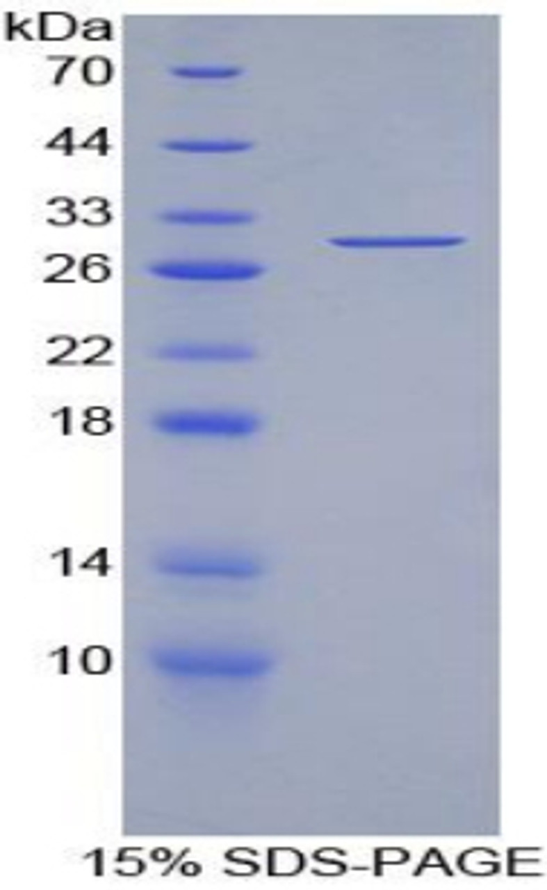 Human Recombinant Torsin 3A (TOR3A)