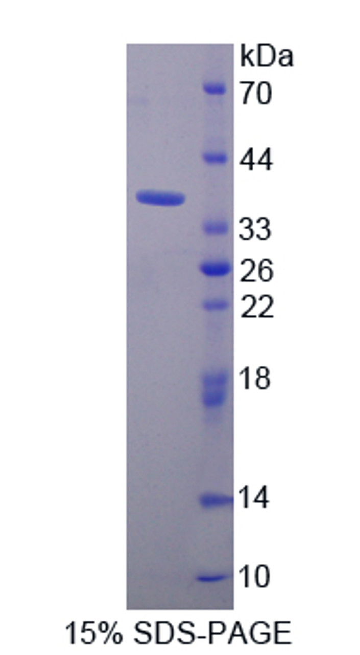 Human Recombinant Torsin 1A (TOR1A)