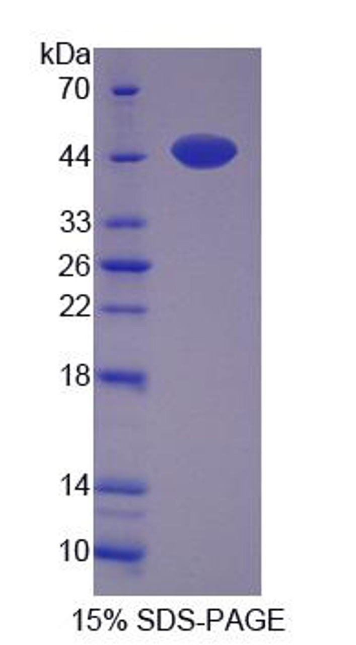 Human Recombinant Myopalladin (MYPN)