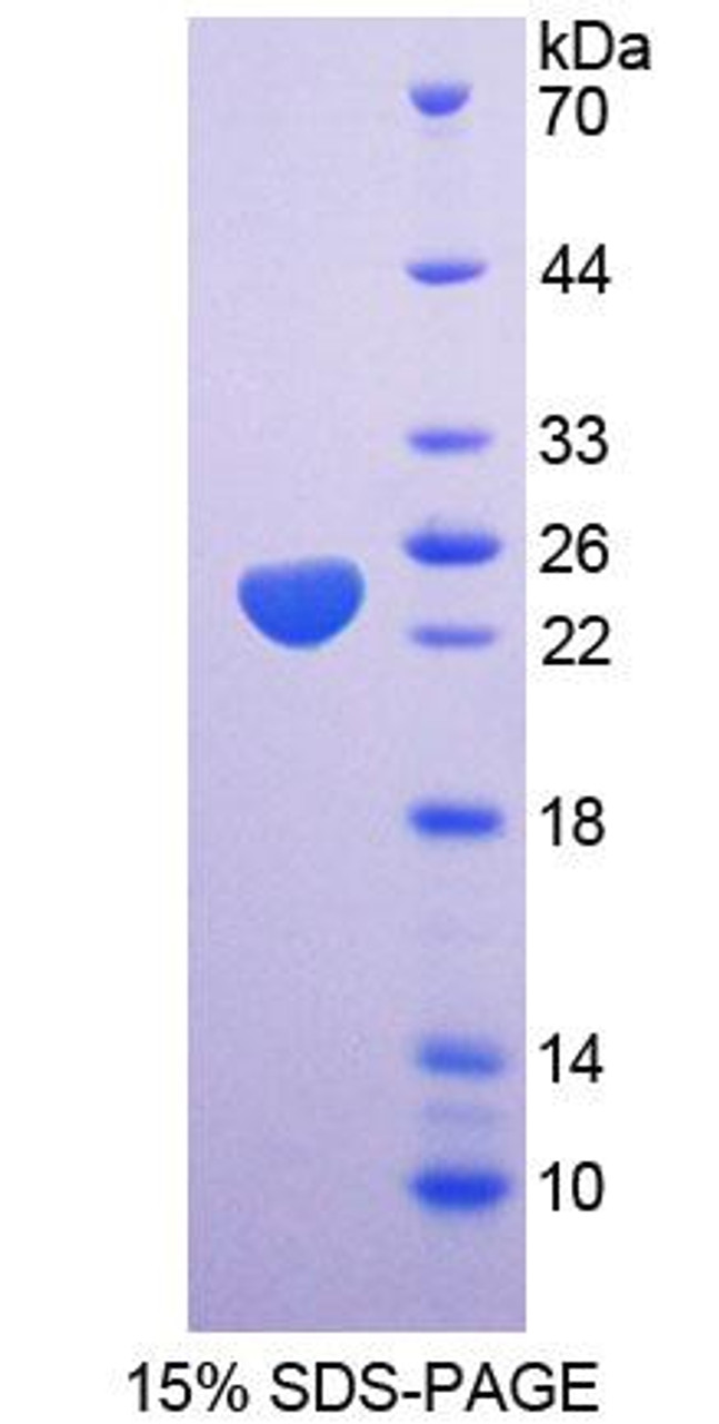 Rat Recombinant Spermidine/Spermine N1-Acetyltransferase 1 (SAT1)
