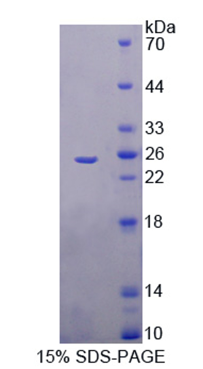 Human Recombinant Trehalase (TREH)