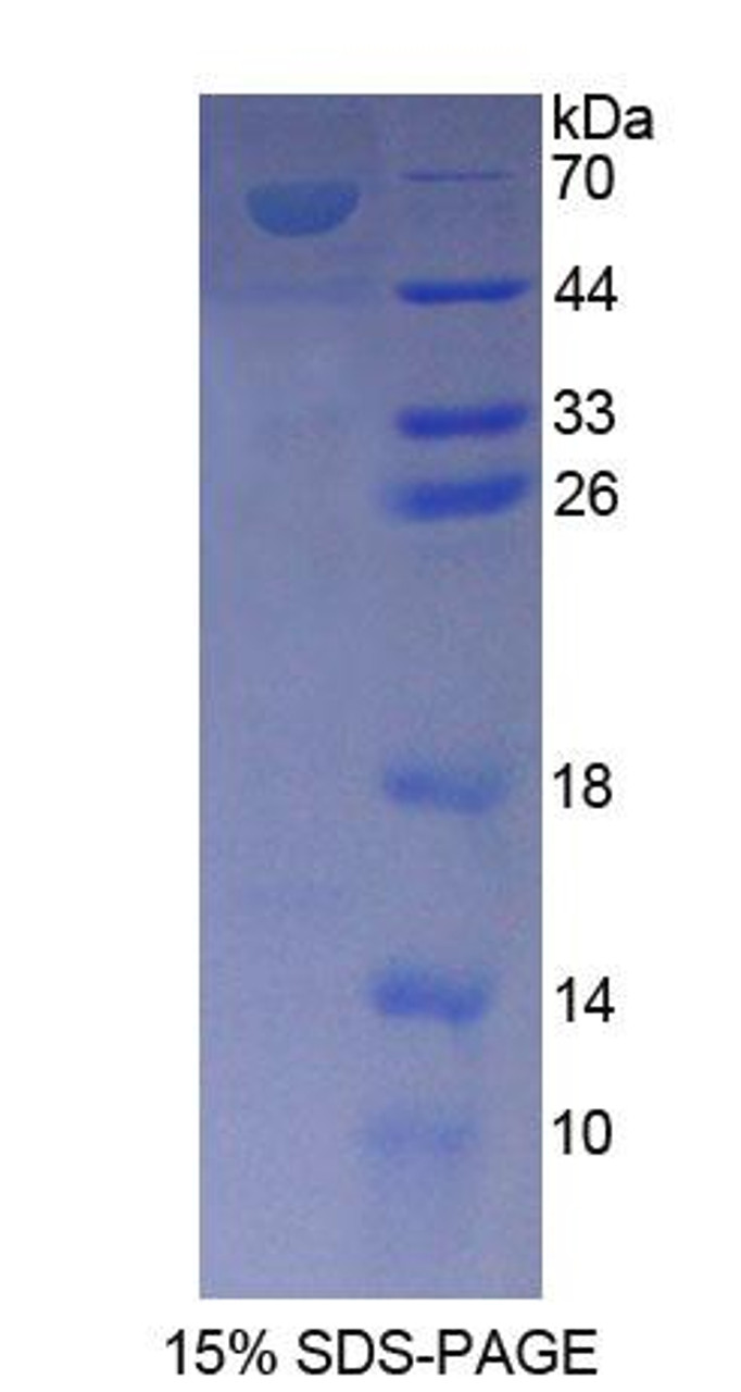 Rat Recombinant Ankyrin Repeat Domain Protein 1 (ANKRD1)