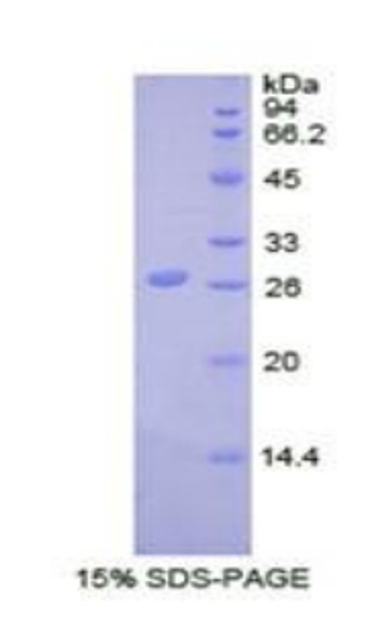 Cattle Recombinant Ubiquitin Carboxyl Terminal Hydrolase L5 (UCHL5)