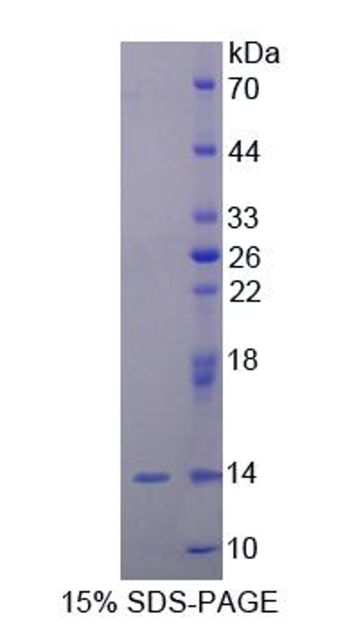 Human Recombinant Ubiquilin 2 (UBQLN2)