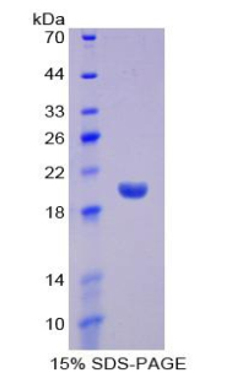 Mouse Recombinant Interferon Alpha 13 (IFNa13)