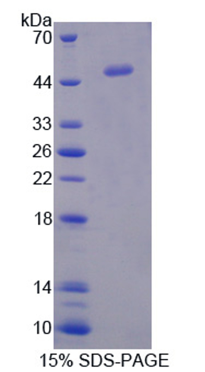 Mouse Recombinant Interferon Alpha 5 (IFNa5)