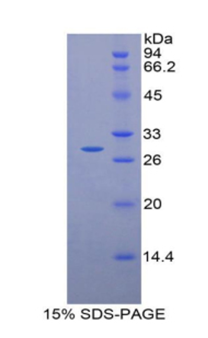 Rat Recombinant TTK Protein Kinase (TTK)