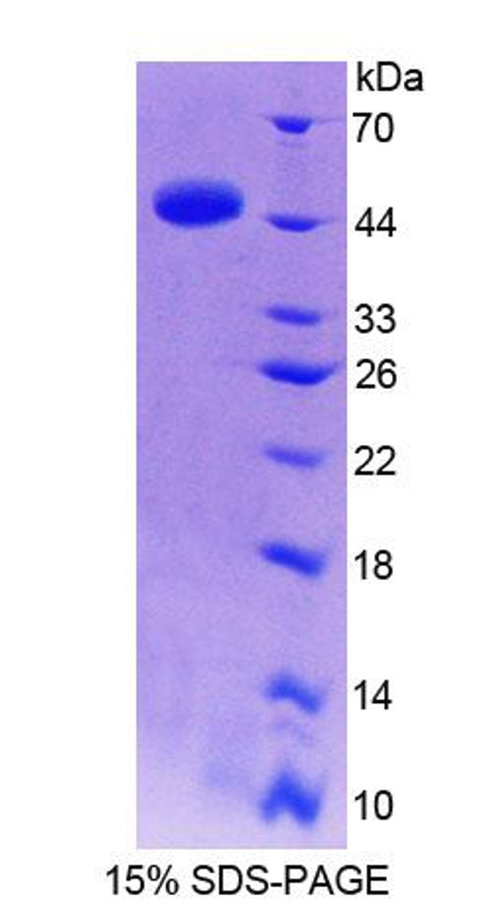 Human Recombinant Thyroid Hormone Receptor Interactor 6 (TRIP6)