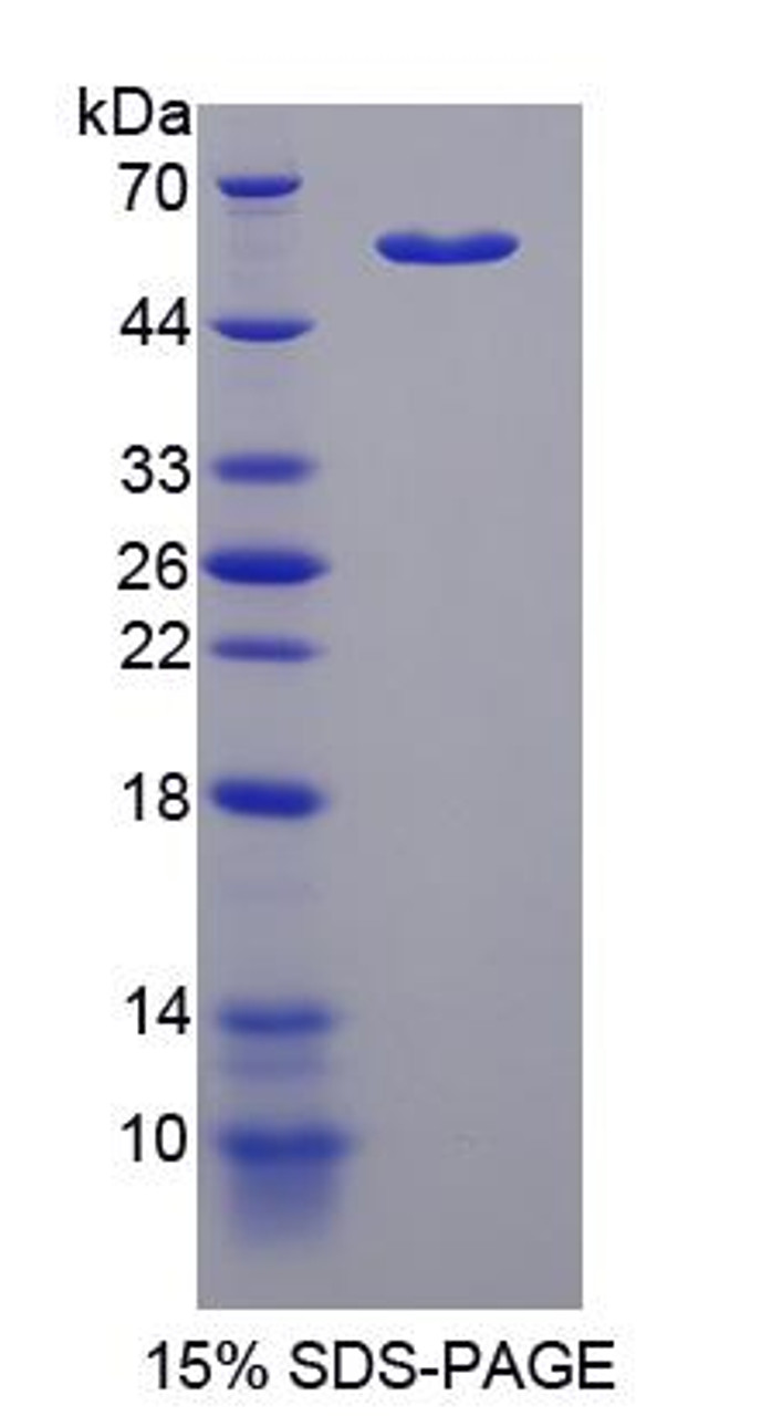 Human Recombinant Transketolase Like Protein 1 (TKTL1)