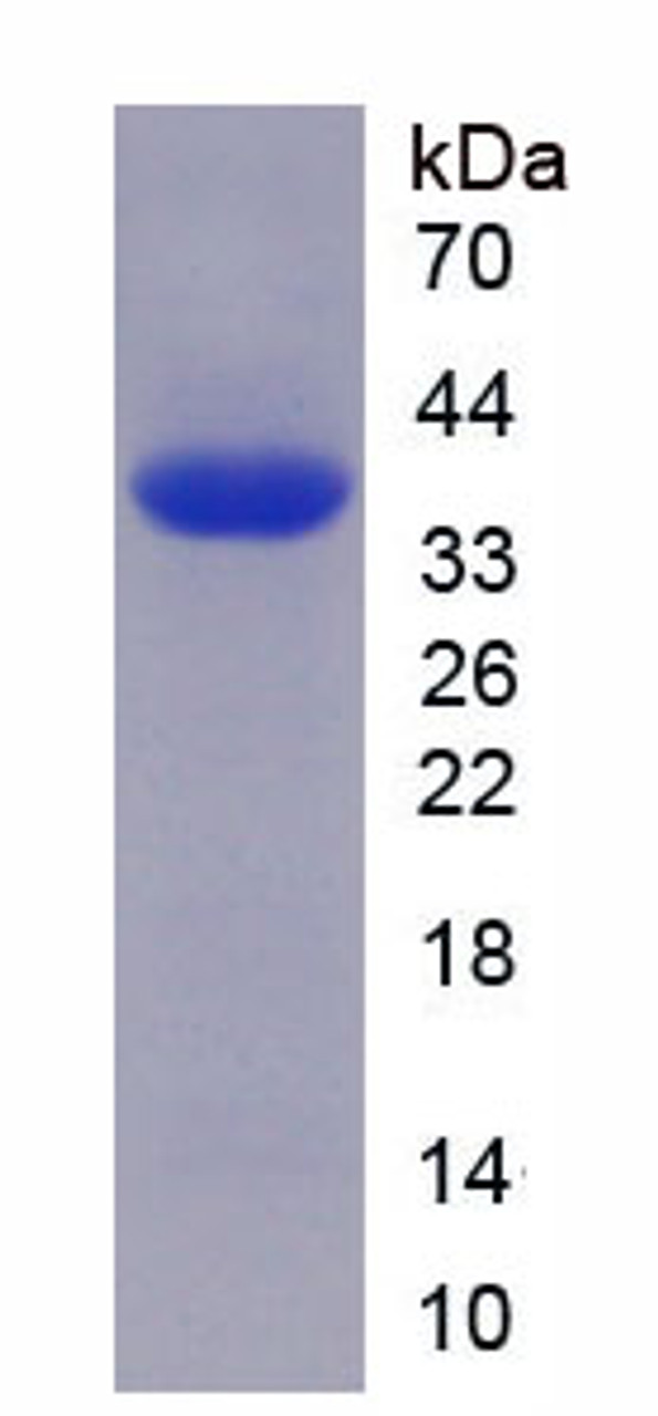 Mouse Recombinant Toll Like Receptor Adaptor Molecule 1 (TICAM1)