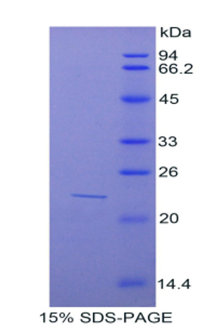 Mouse Recombinant Sulfite Oxidase (SUOX)