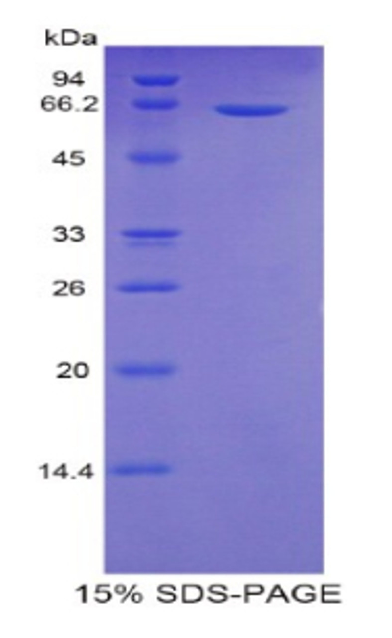 Human Recombinant Sulfatase 2 (SULF2)