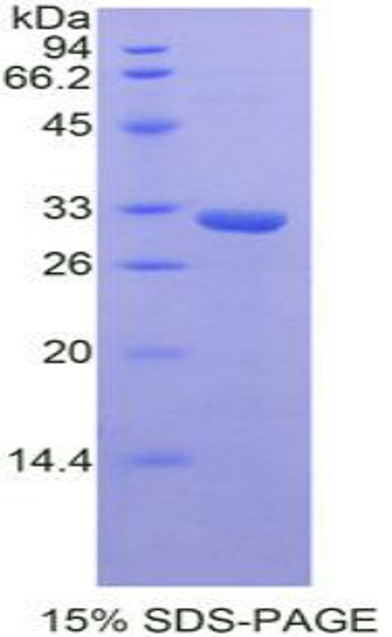 Mouse Recombinant STAM Binding Protein (STAMBP)