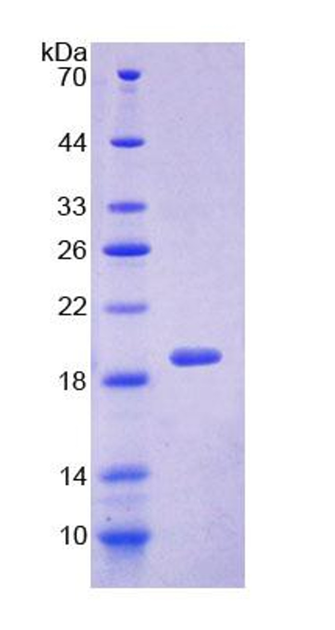 Human Recombinant Sorcin (SRI)