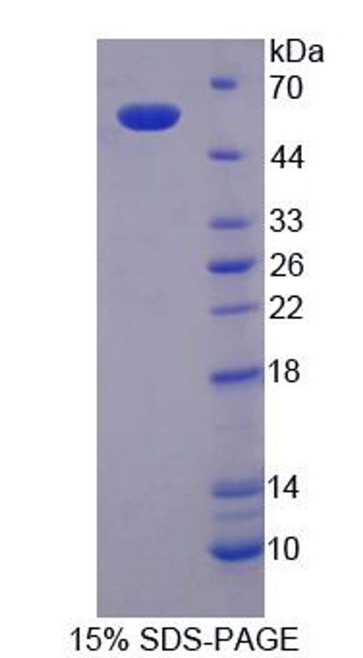 Mouse Recombinant Serine Palmitoyltransferase, Long Chain Base Subunit 3 (SPTLC3)